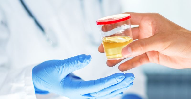 Will CBD Show Up on a Drug Test? | California Weed Blog